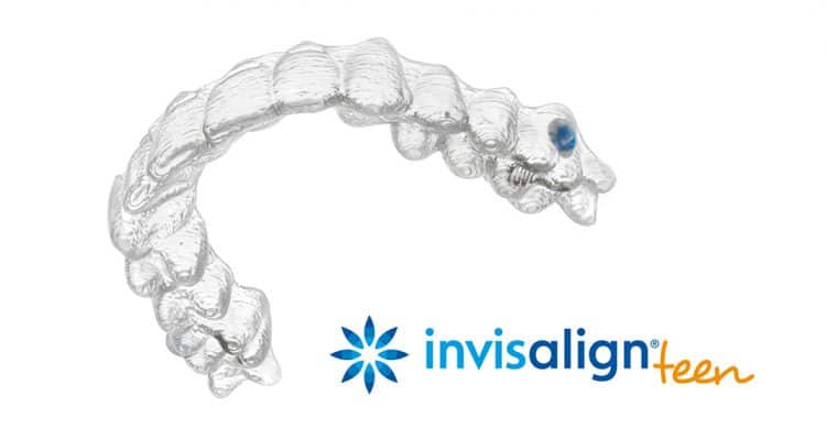 Invisalign Teen Compliance Indicator