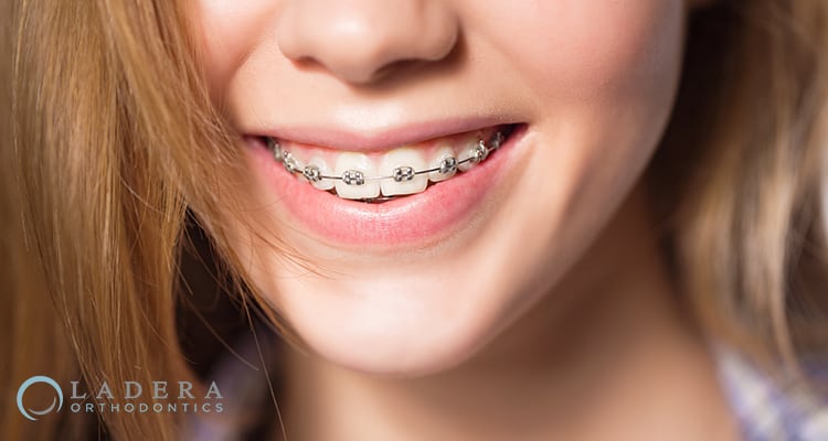 Paying for orthodontics