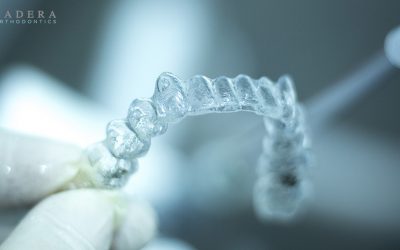 Invisalign Orange County