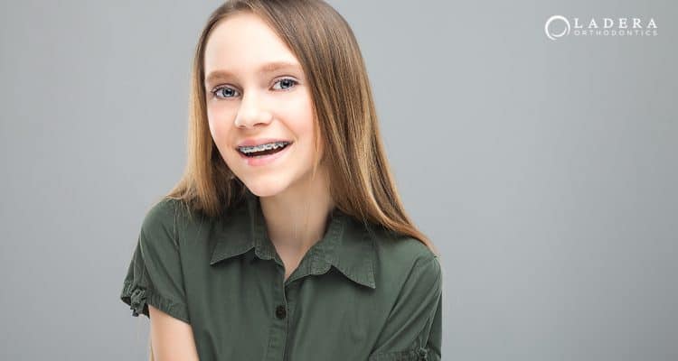 Cost of Braces in Orange County