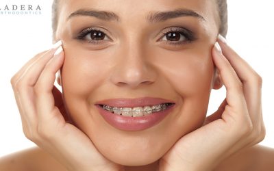 Prevent Teeth Staining