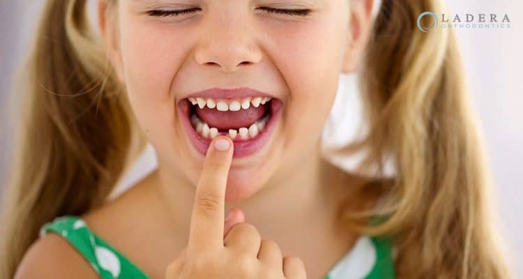 losing baby teeth